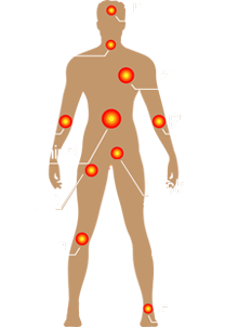 Pain Management in Houston, TX and Sugar Land, TX