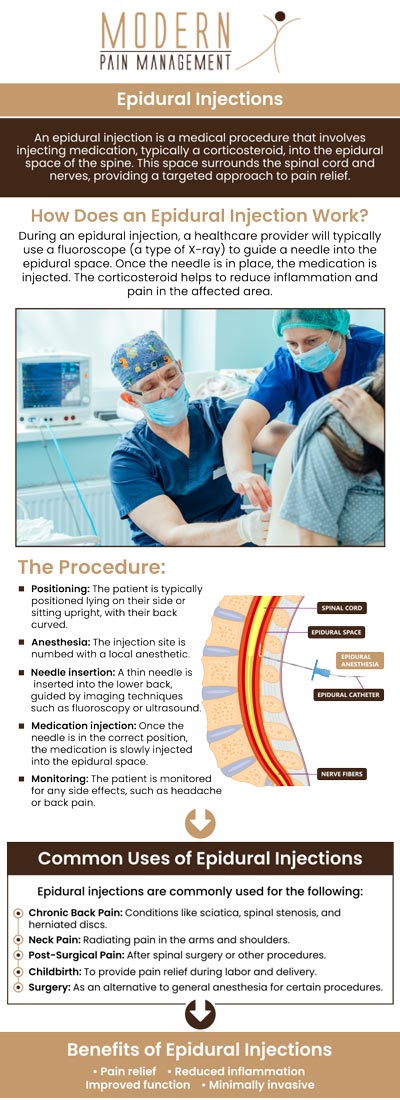 Epidural steroid injections are a common treatment to reduce inflammation and relieve pain in the spine. They target specific areas to help improve mobility and comfort, especially for conditions like herniated discs or spinal stenosis. Visit Dr. Atallah, DO, for personalized epidural steroid injections designed to relieve pain and improve your quality of life. For more information, please contact us or book an appointment online. We have convenient locations to serve you in Houston TX and Sugar Land TX. Epidural steroid injections are a common treatment to reduce inflammation and relieve pain in the spine. They target specific areas to help improve mobility and comfort, especially for conditions like herniated discs or spinal stenosis. Visit Dr. Atallah, DO, for personalized epidural steroid injections designed to relieve pain and improve your quality of life. For more information, please contact us or book an appointment online. We have convenient locations to serve you in Houston TX and Sugar Land TX.