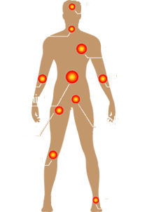 Pain Management in Houston, TX and Sugar Land, TX Pain Management in Houston, TX and Sugar Land, TX